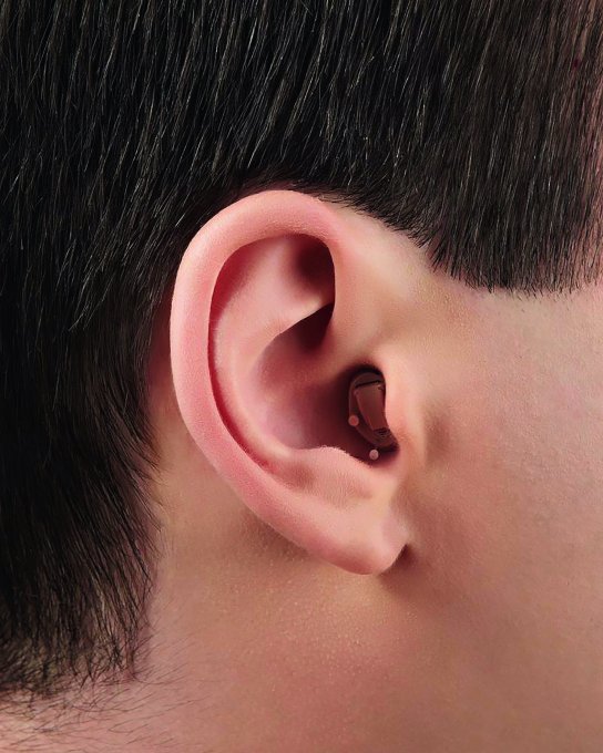 Aide auditive intra-auriculaire